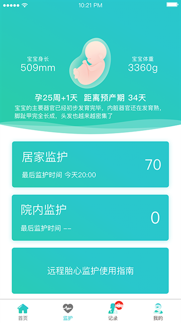 胎心监护