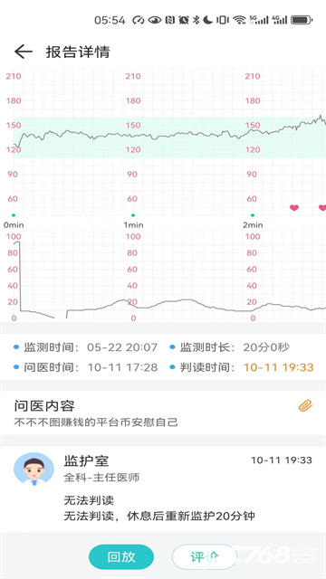 胎心监护