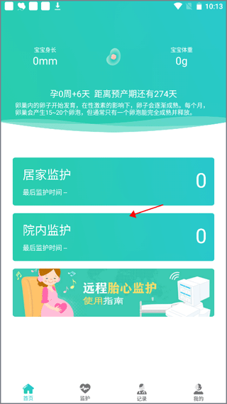 胎心监护