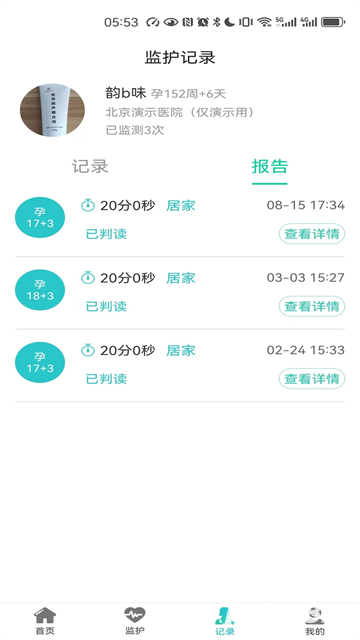 胎心监护